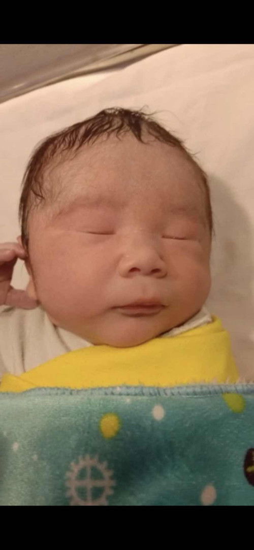 Berbagi pengalaman kemarin ketuban pecah dini