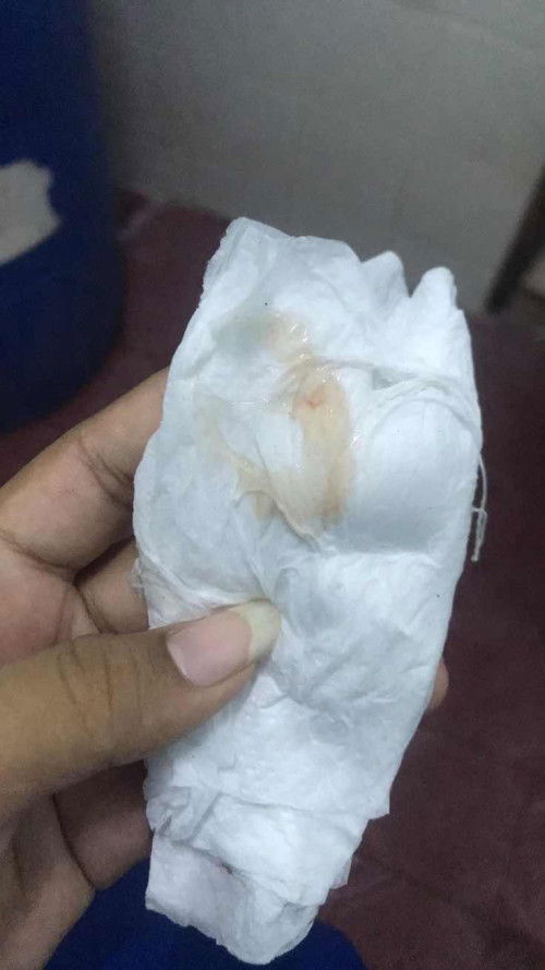 โดนตรวจภายใน