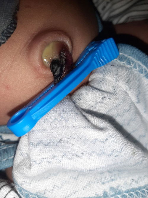 Ini nanah atau bukan yah ? Terus gimana penanganannya menurut pengalaman bunda bunda sekalian ?