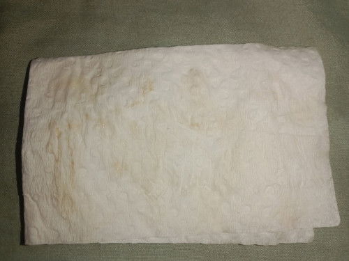 ควรไปพบแพทย์มั้ยคะ