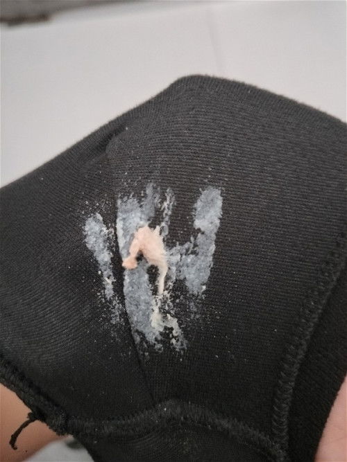 30 วีค 3 วันออกมาแบบนี้ปกติไหมค่ะ