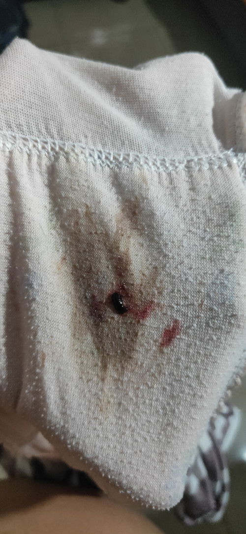 Keluar flek campur darah