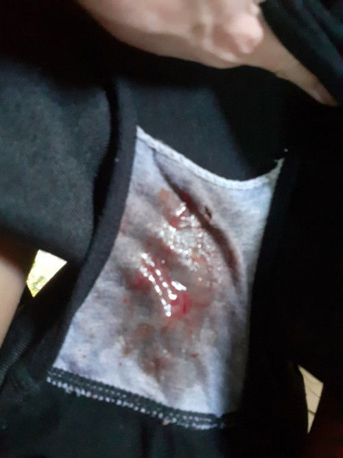 หลังคลอดหนักของหนัก