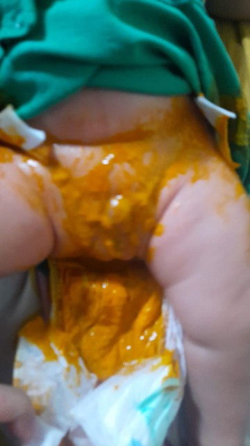 Baru pup setelah 3 hari dan langsung banyak