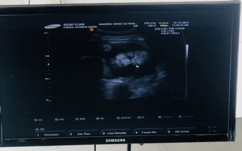 25 weeks baby ❤️