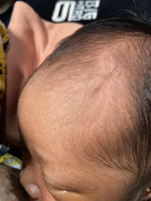 Bintik kecil seperti air