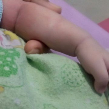 Bun ad yg penglaman bayinya bintik merah ginu gak ? Klo ad salep yg dipake apa y