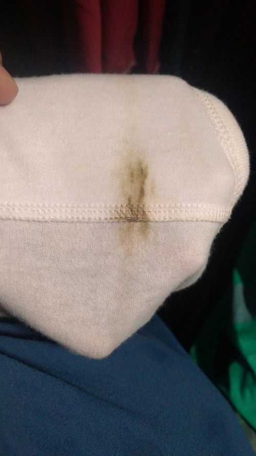 Maaf agak jorok. Flek