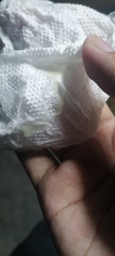 เป็นแบบนี้คืออะไรหรอคะ