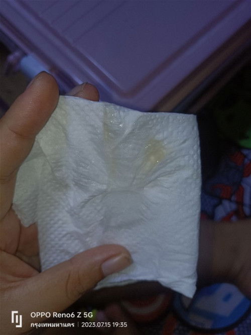 การตั้งครรภ์ 39+1