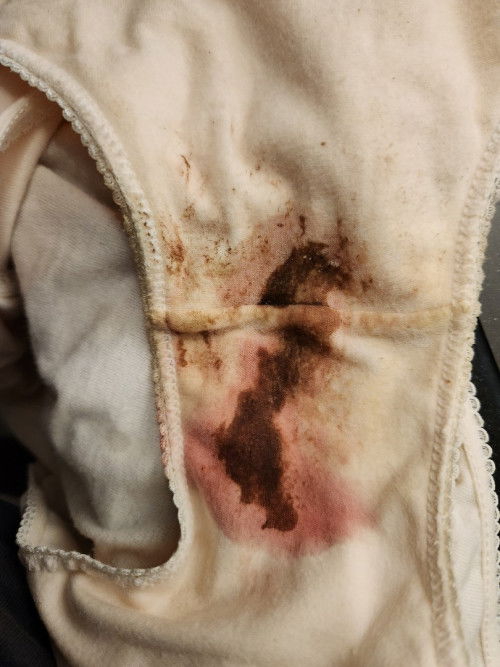 Ano po ibig sabihin ng ganitong discharge? Currently 39weeks na po. Thankyou po sa makakasagot