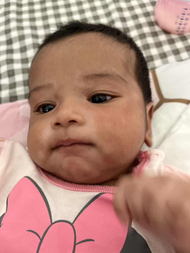 Tompok putih pada kulit