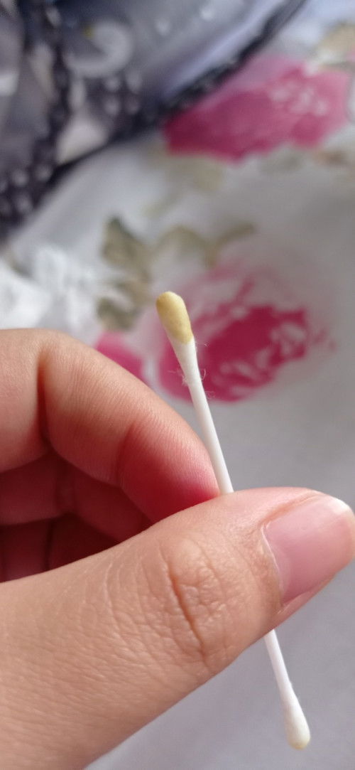 KOTORAN TELINGA BAYI