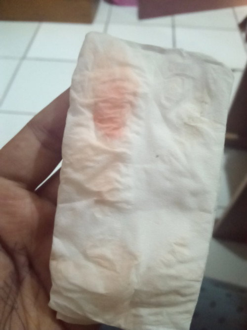 Keluar flek