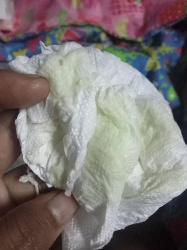 ท้องแรก30+4w