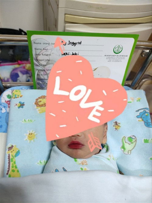 Alhamdulillah telah lahir putra saya tgl 14 Juli kemarin dgn proses SC..