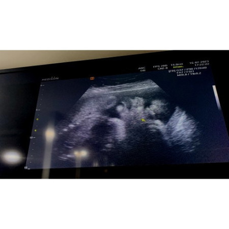 มาอวดเจ้าก้อนกันเถอะ 🤰🏻🤍🥰