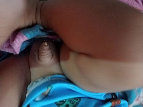 lumalabas na orange sa tite ng 5 months old