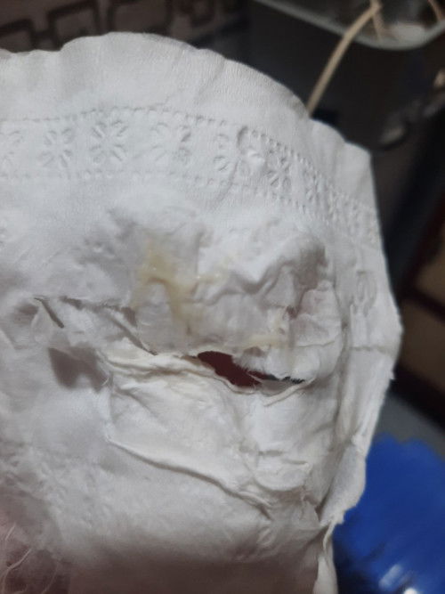 Xin phép ạ .các m cho e hỏi v có phải bung nút nhầy k ạ e bầu 38w rồi tập đầu ạ