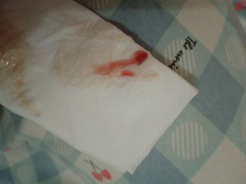 39 week 2day keluar lendir tapi perut tidak sakit