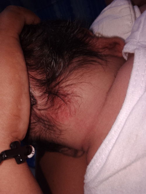 Ano po pwede pang ipahid sa rashes ni Lo