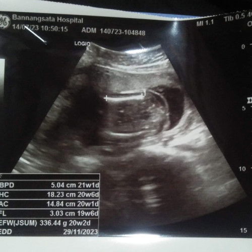 ในรูป หญิงหรือชายค่ะ คุณแม่ดูไม่ออกค่ะ