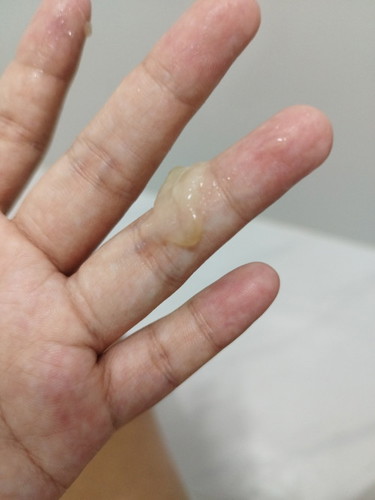 Mucus plug