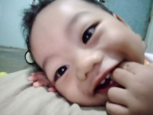 Hiwalay na ngipin sa taas..