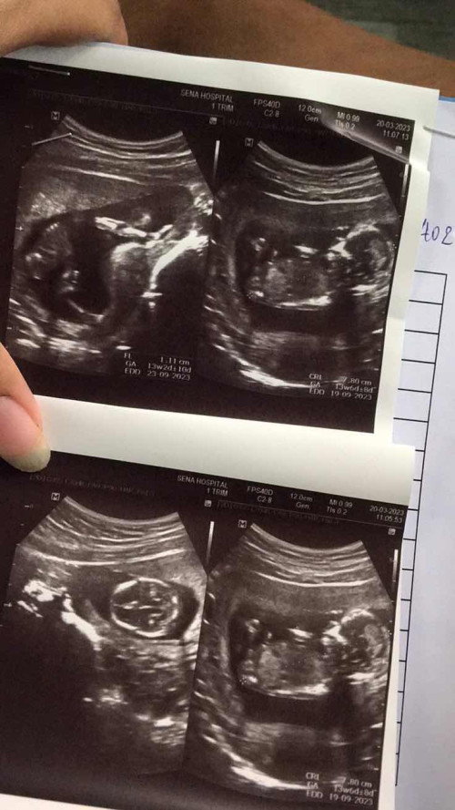 สอบถามเรื่องเพศ