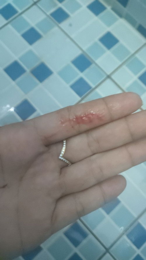 Hamil lagi anak masih 2 tahun 6 bulan