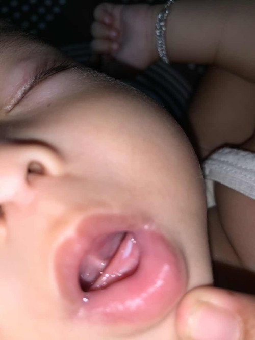 Bayi tumbuh gigi