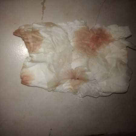 Hello po tanong ko lang po normal lang po ba ito 39 weeks na po ako salamat po sa sasagot