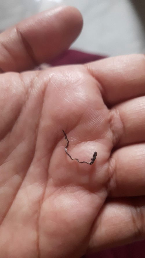 Bund mau tanya saya brau mlahirkan  5 hari tapi benamg putus kayak gini ,. Apakah jahitan saya aman?