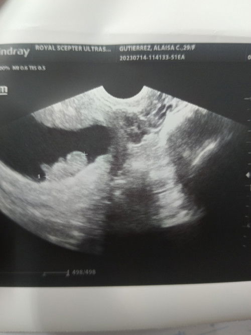 My 3 months old baby..