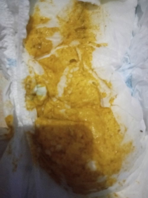 maap jorok anaku lagi diare bbrp hari ini kmrin abis dirawat dan skrng ee ny msih gini ,apa ini msi