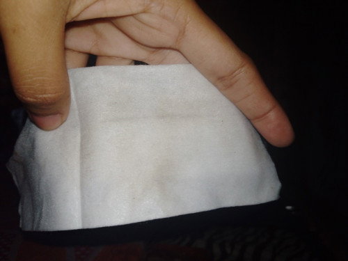 Discharge during pregnancy