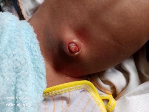 Tentang pusar bayi (udel)