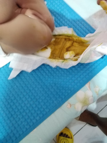 Gudpm po mga mommy tnung ko kng po normal pi b tong dumi ng b2y ko? 4months old po b2y ko. Slmt po s