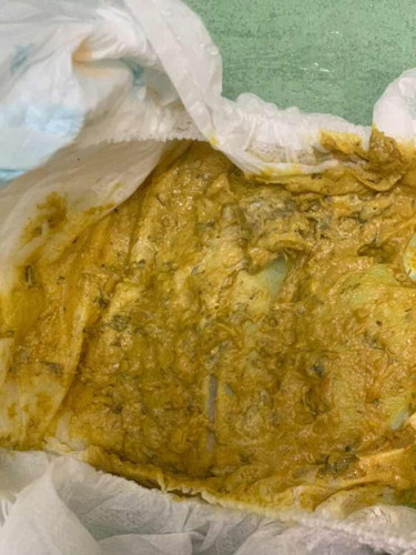 baby 10 bulan berak cair lepastu ada hitam kecik kecik