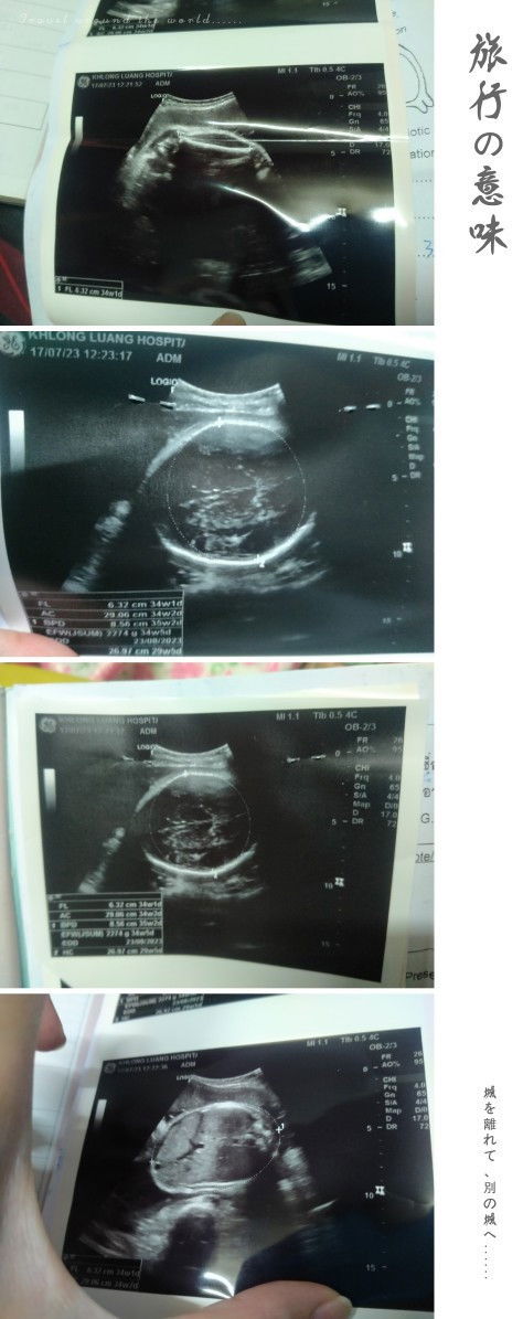 ดูใบอัลตราซาวด์ ช่วยหน่อยค่ะ