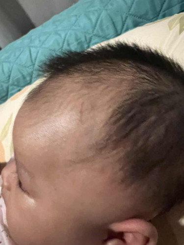 เล็บลูกสามารถเป็นแผลได้ขนาดนี้มั้ยครับ