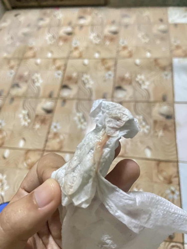 38+6 ถ้ามีอาการปวดท้องเหมือนปวดประจำเดือน ปวดแล้วคลาย  ท้องเเข็งร่วมด่วยแต่ท้องเเข็งก็คลายไป  ต้องไปรพ เลยไหมคะ