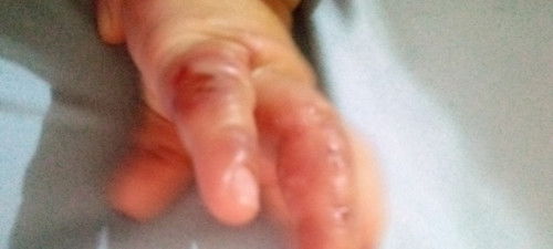 Rencana periksa ke dokter kulit ..