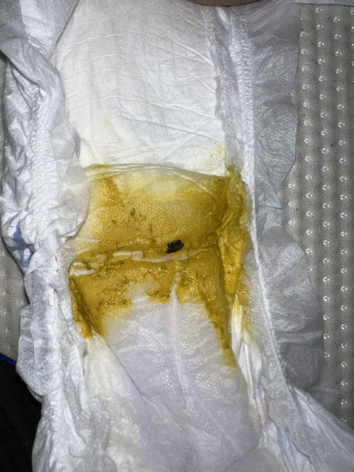 Najis ad benda hitam