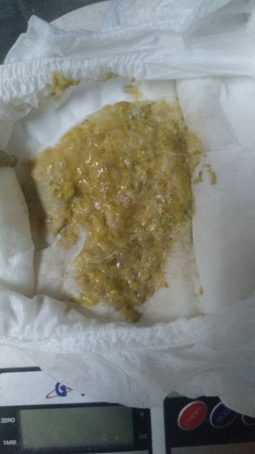 Disentri di usia 6 bulan