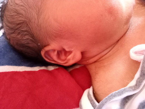 Bintik putih di kulit bayi