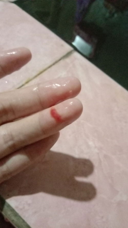 Pertanyaan hamil 11 mimggu