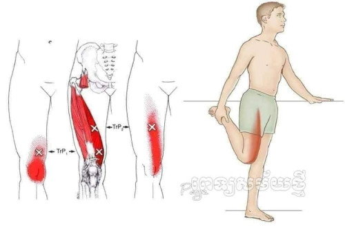 Sakit kaki kanan diatas bahagian lutut