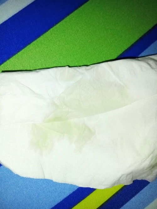 Keputihan / Ketuban?