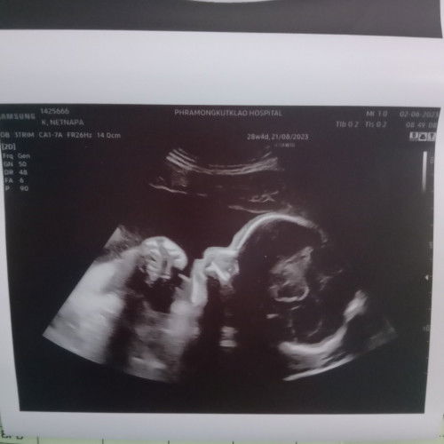 #ธีมสิงหาคม มีแม่ๆคนไหนกำหนด ส.คบ้างค่ะ